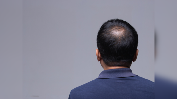 The 'slow fade' vs the 'sudden shed'