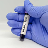 How often should someone get their HbA1c tested, especially if their daily sugar levels seem normal?