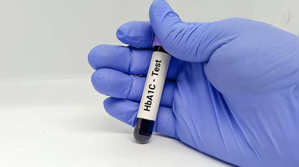 How often should someone get their HbA1c tested, especially if their daily sugar levels seem normal?