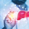 Article image for: What are the risk factors that trigger liver disease in diabetes <i class="tbold">patient</i>s?
