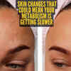 Article image for: Is your metabolism slowing <i class="tbold">down</i>? 5 skin signs to watch for