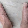 Skin changes that should never be ignored