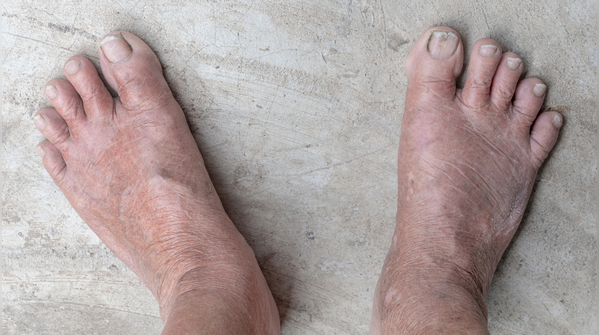 Skin changes that should never be ignored