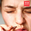 Article image for: 7 easy natural remedies to remove facial hair at home for women with PCOS