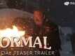 Normal - Official Trailer​​​​​​​​​​​​​​​​​​​​​​​​​​​​​​​​​​​​​​​​​​​​​​​​​​​​​​​​​​​​​​​​​​​​​​​​​​​​​​​​​​​​​​​​​​​​​​​​​​​​​​​​​​​​​​​​​​​​​​​​​​​​​​​​​​​​​​​​​​​​​​​​​​​​​​​​​​​​​​​​​​​​​​​​​​​​​​​​​​​​​​​​​​​​​​​​​​​​​​​​​​​​​​​​​​​​​​​​​​​​​​​​​​​​​​​​​​​​​​​​​​​​​​​​​​​​​​​​​​​​​​​​​​​​​​​​​​​​​​​​​​​​​​​​​​​​​​​​​​​​​​​​​​​​​​​​​​​​​​​​​​​​​​​​​​​​​​​​​​​​​​​​​​​​​​​​​​​​​​​​​​​​​​​​​​​​​​​​​​​​​​​​​​​​​​​​​​​​​​​​​​​​​​​​​​​​​​​​​​​​​​​​​​​​​​​​​​​​​​​​​​​​​​​​​​​​​​​​​​​​​​​​​​​​​​​​​​​​​​​​​​​​​​​​​​​​​​​​​​​​​​​​​​​​​​​​​​​​​​​​​​​​​​​​​​​​​​​​​​​​​​​​​​​​​​​​​​​​​​​​​​​​​​​​​​​​​​​​​​​​​​​​​​​​​​​​​​​​​​​​​​​​​​​​​​​​​​​​​