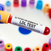 Understanding beats fearing cholesterol