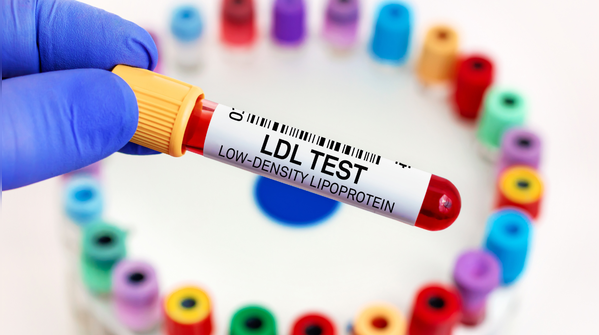 Understanding beats fearing cholesterol