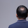 Should you stop Ozempic because of hair fall?