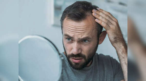 Signs you might be experiencing Ozempic-related hair fall