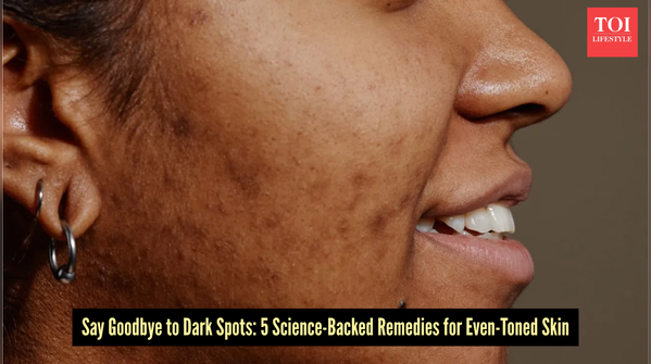 Pigmentation Treatment at Home