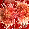 What happens if someone is diagnosed?