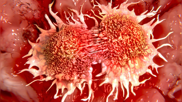 What happens if someone is diagnosed?