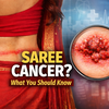 Article image for: All we need to know about 'Saree Cancer'