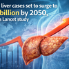 Article image for: Fatty liver cases set to surge to 1.8 billion by 2050, warns Lancet study
