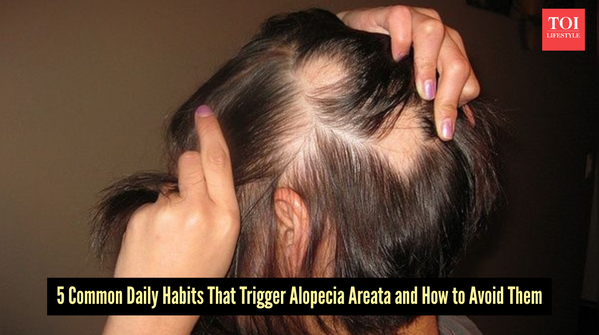 Everyday activities triggering alopecia areata