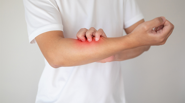 Itching that doesn’t have a visible cause