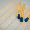 Changes in urine and stool that seem harmless