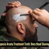 Article image for: Will shaving your hair fix alopecia areata?