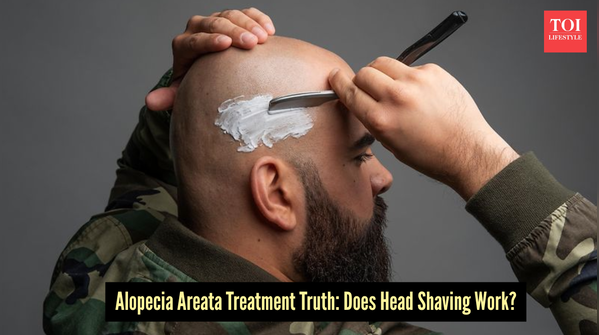 Will shaving your hair fix alopecia areata?