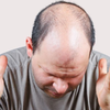 Can hair regrowth still happen?