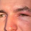 Article image for: Why the eyes <i class="tbold">show</i> it first