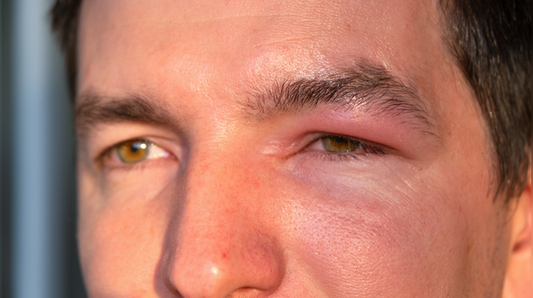 Why the eyes show it first