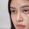 Article image for: When eye puffiness signals more and sleep isn’t the answer