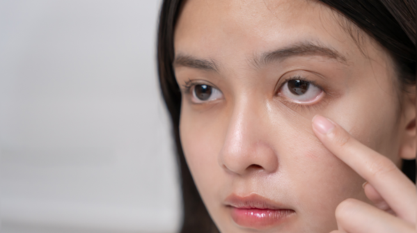 When eye puffiness signals more and sleep isn’t the answer
