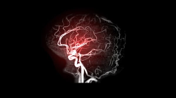 Medical experts consulted