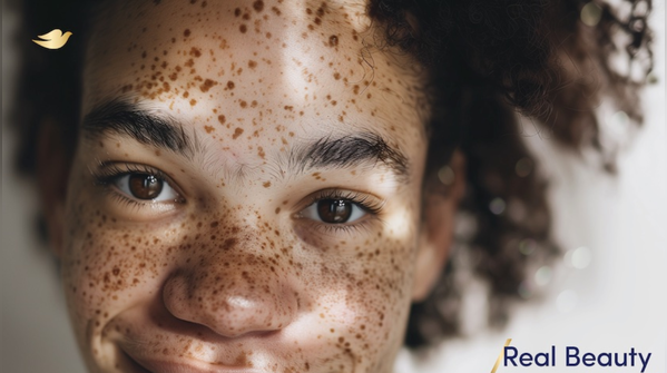 Dove and their real beauty campaign