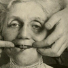 Article image for: The <i class="tbold">dimple</i> maker