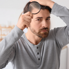 Article image for: <i class="tbold">hair loss</i> that doesn't stop