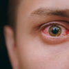 What actually happens when you get an eye infection