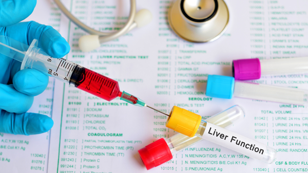 Non Photos