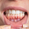 Brushing harder does not mean cleaner