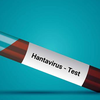 Article image for: The history of hantavirus actually goes back further than most people realize