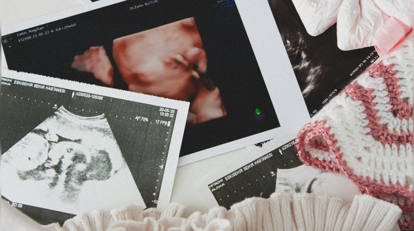 Myth 2: IVF can fix everything