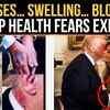 Article image for: Donald Trump Health Buzz Explodes After Viral Hand Photos