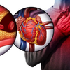 Chest pain or discomfort