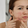 Why skin problems often start internally