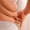Predominance of belly fat
