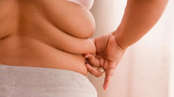 Predominance of belly fat