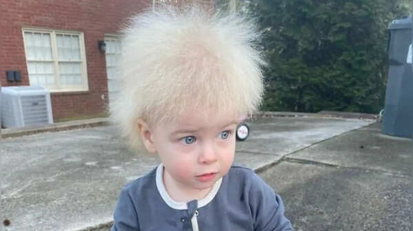 5 bizarre human syndromes that sound unbelievable but are real