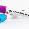 Medical experts consulted