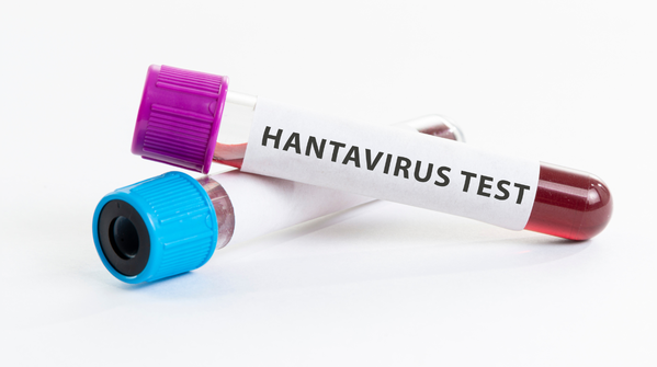 Medical experts consulted
