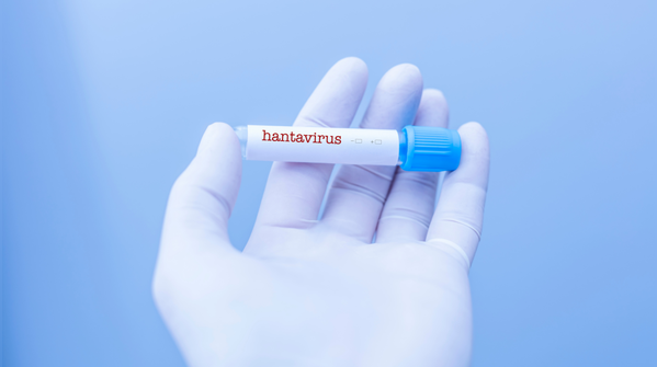 What exactly is Hantavirus and why does it worry doctors?