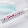 Article image for: Hantavirus is serious but not easily contagious