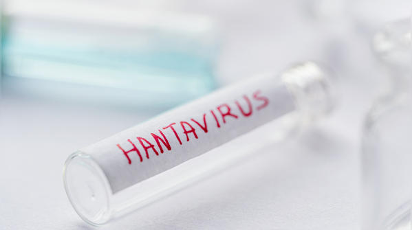 Hantavirus is serious but not easily contagious