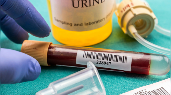 Who faces higher risk?