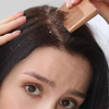 Article image for: Sending Dandruff Packing